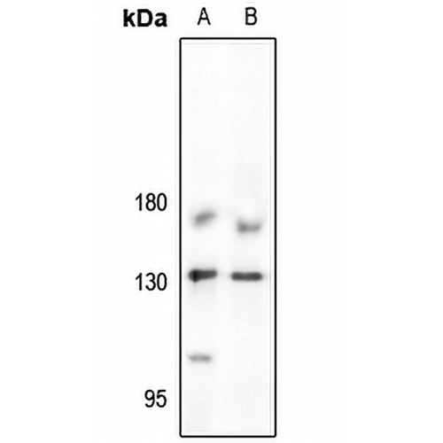 JAK1 Rabbit Polyclonal Antibody