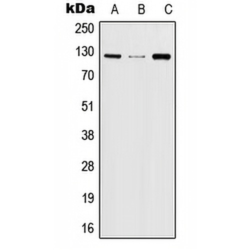 JAK2 (Phospho-Y570) Rabbit Polyclonal Antibody