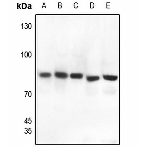 Gamma-catenin Rabbit Polyclonal Antibody