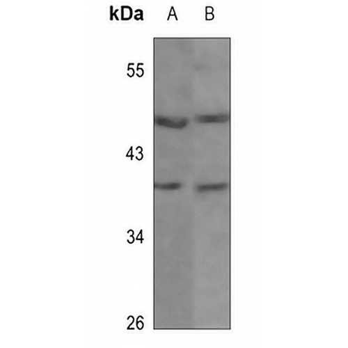 Kir4.1 Rabbit Polyclonal Antibody