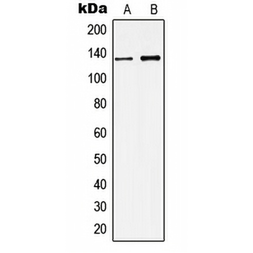 KCNMA1 Rabbit Polyclonal Antibody