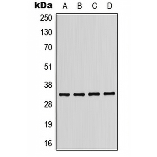 CD158b1 Rabbit Polyclonal Antibody