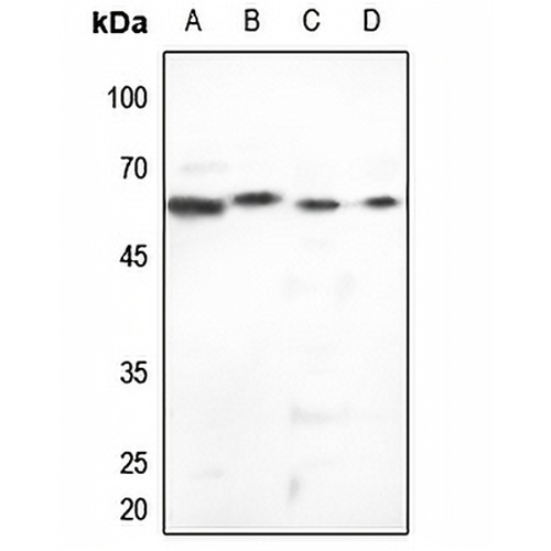 Cytokeratin 5 Rabbit Polyclonal Antibody