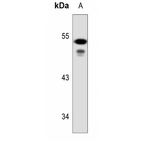 Cytokeratin 7 Rabbit Polyclonal Antibody