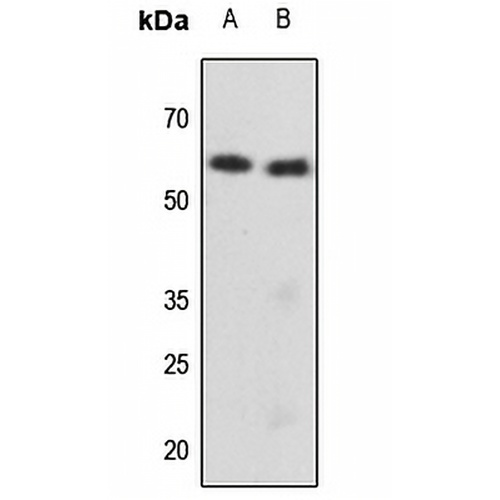 Cytokeratin 8 (Phospho-S73) Rabbit Polyclonal Antibody