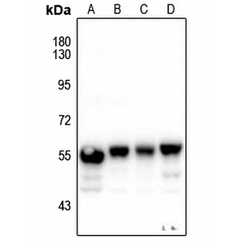 Cytokeratin 8 Rabbit Polyclonal Antibody