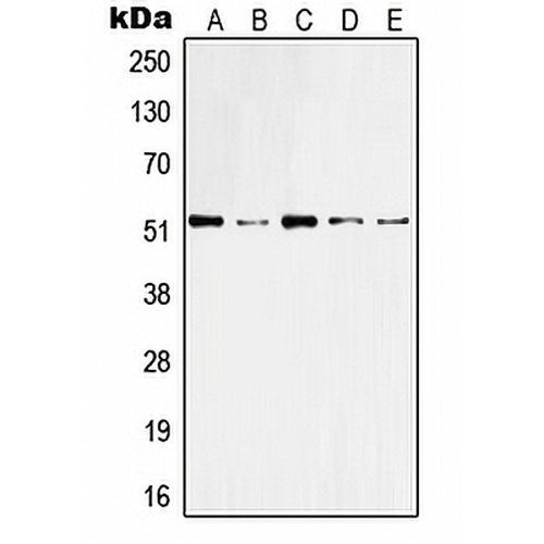Cytokeratin 10 Rabbit Polyclonal Antibody