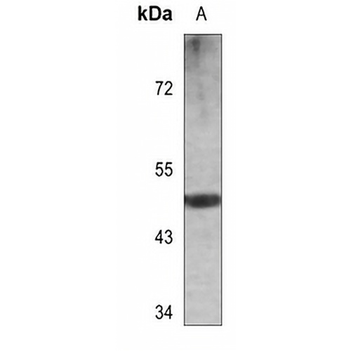 Cytokeratin 13 Rabbit Polyclonal Antibody