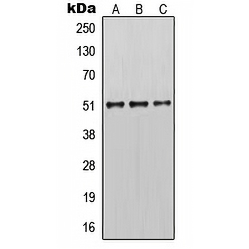 Cytokeratin 14 Rabbit Polyclonal Antibody