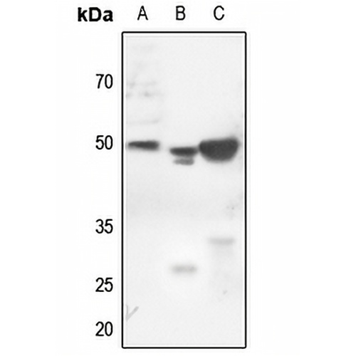 Cytokeratin 18 (Phospho-S52) Rabbit Polyclonal Antibody
