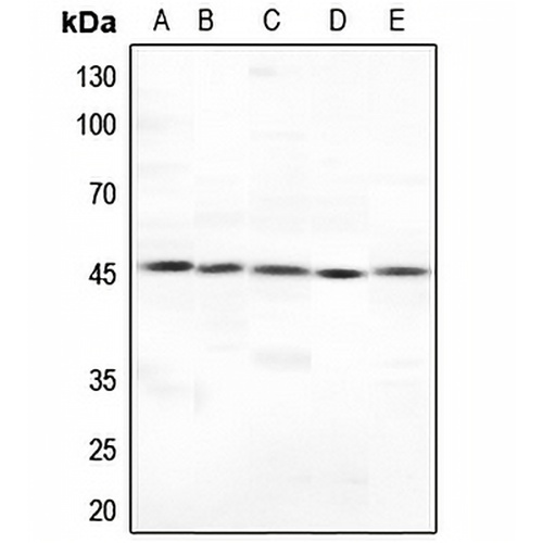 Cytokeratin 18 Rabbit Polyclonal Antibody