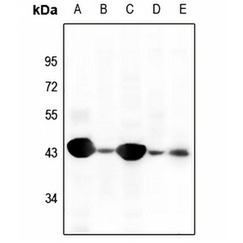 Cytokeratin 19 Rabbit Polyclonal Antibody