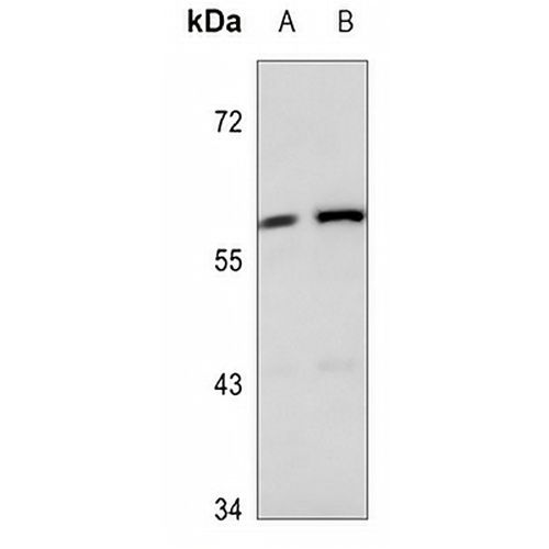 Cytokeratin 84 Rabbit Polyclonal Antibody