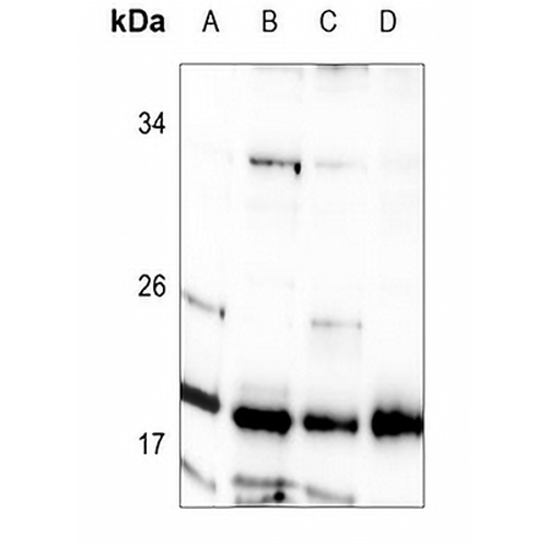 STMN1 Rabbit Polyclonal Antibody