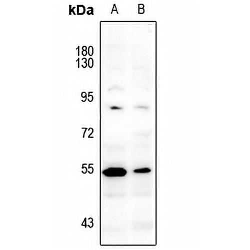 LCK (Phospho-Y393) Rabbit Polyclonal Antibody