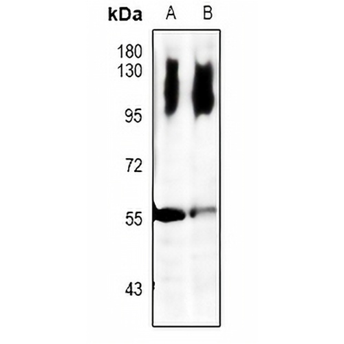LCK Rabbit Polyclonal Antibody