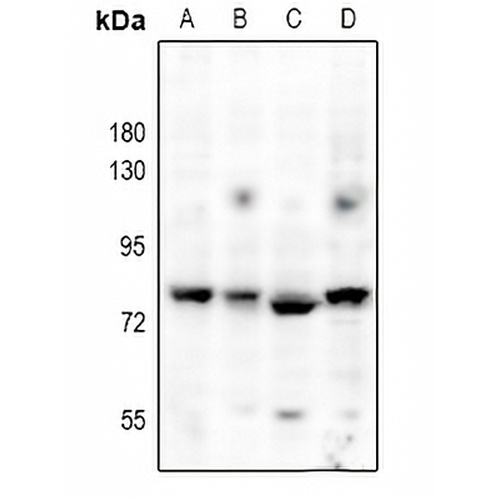 SLP76 Rabbit Polyclonal Antibody