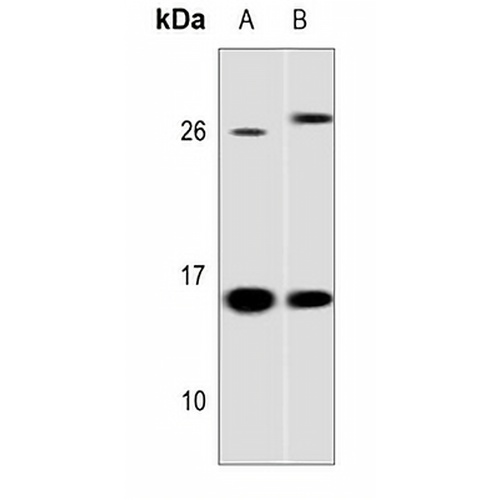 Galectin 1 Rabbit Polyclonal Antibody