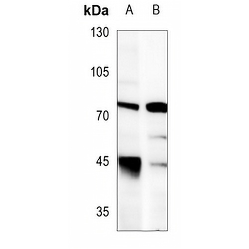 LIMK1 Rabbit Polyclonal Antibody
