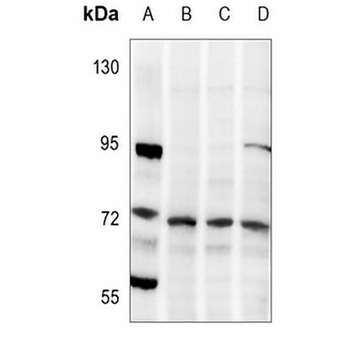 LIMK1/2 (Phospho-T508/505) Rabbit Polyclonal Antibody