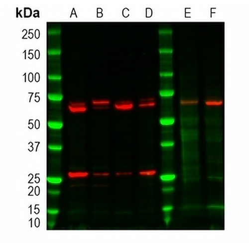 Hepatic Lipase Rabbit Polyclonal Antibody