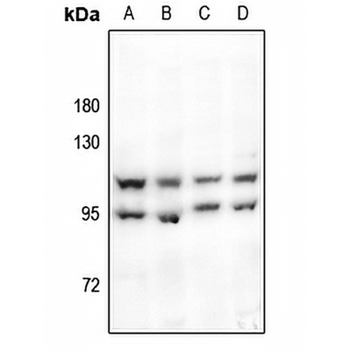 HSL Rabbit Polyclonal Antibody