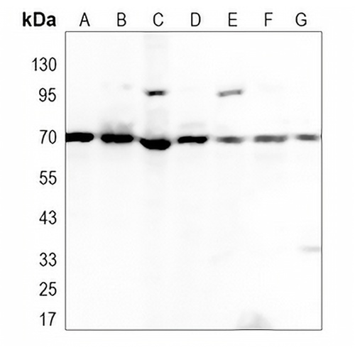 Lamin B1 Rabbit Polyclonal Antibody