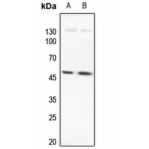 LMX1B Rabbit Polyclonal Antibody