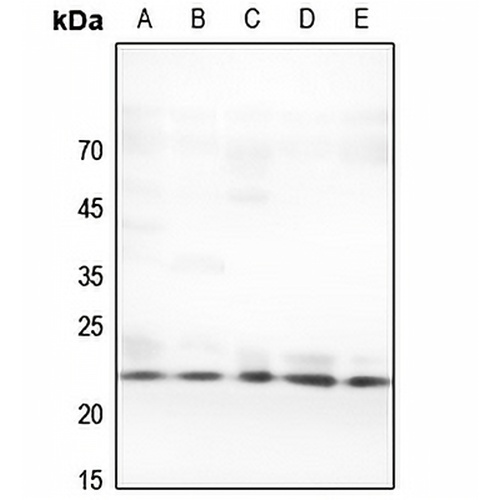 TNF beta Rabbit Polyclonal Antibody