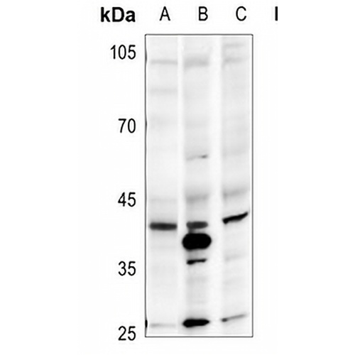 CD326 Rabbit Polyclonal Antibody