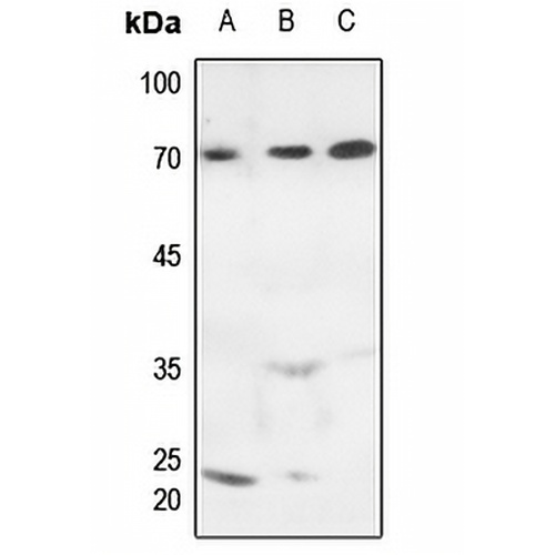 MARCKS (Phospho-S163) Rabbit Polyclonal Antibody