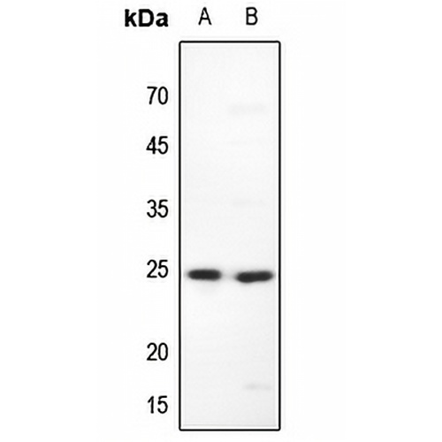 MAD2 Rabbit Polyclonal Antibody