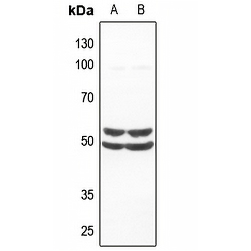 SMAD1 Rabbit Polyclonal Antibody