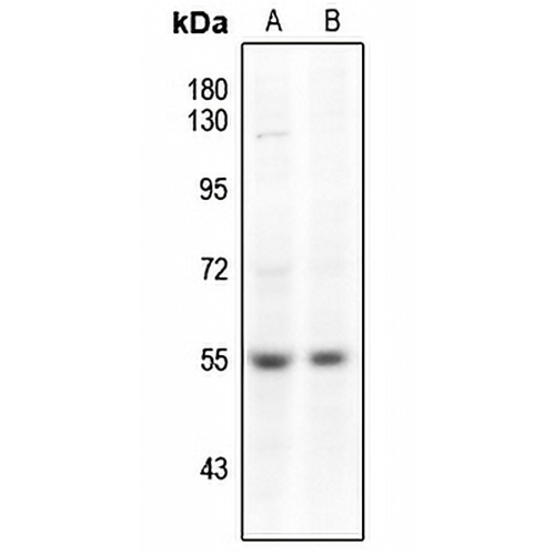 SMAD3 (Phospho-S204) Rabbit Polyclonal Antibody
