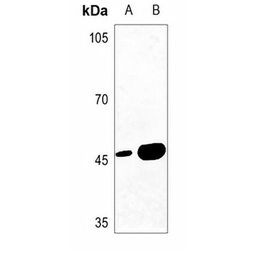 MAGEA1 Rabbit Polyclonal Antibody