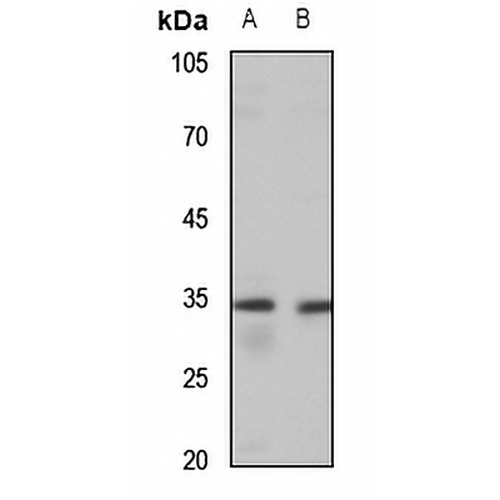 MAGEA3/6 Rabbit Polyclonal Antibody