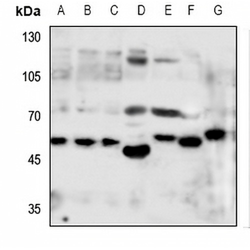 Monoamine Oxidase A Rabbit Polyclonal Antibody