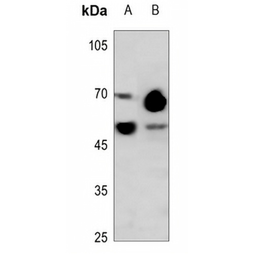 TAU Rabbit Polyclonal Antibody