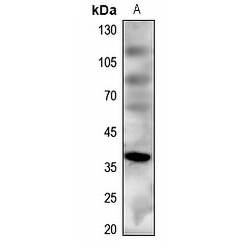 MC4 Receptor Rabbit Polyclonal Antibody