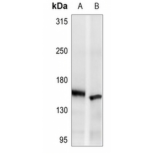 ASK1 Rabbit Polyclonal Antibody