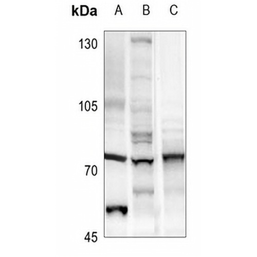 Menin Rabbit Polyclonal Antibody