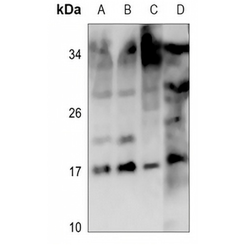 Mammaglobin B Rabbit Polyclonal Antibody
