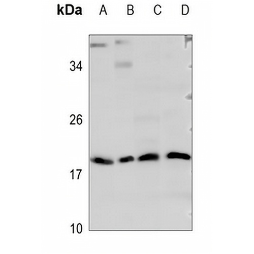 Mammaglobin A Rabbit Polyclonal Antibody