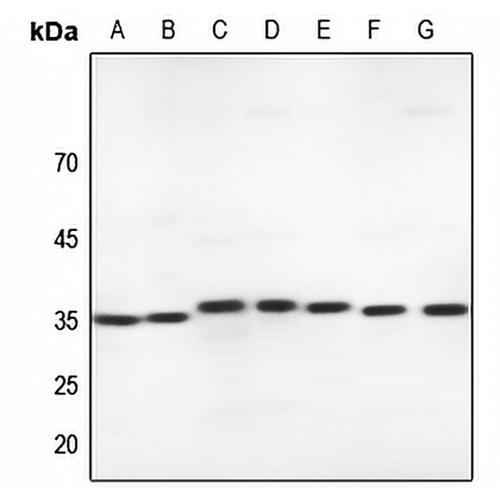MLF1 Rabbit Polyclonal Antibody