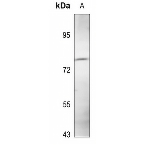MLH1 Rabbit Polyclonal Antibody