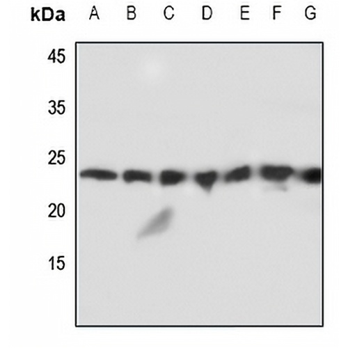 MMP1 22k Rabbit Polyclonal Antibody