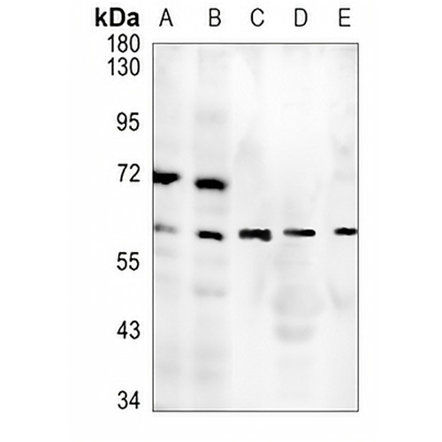 MMP2 Rabbit Polyclonal Antibody