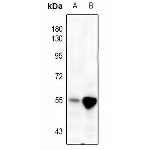 MMP3 Rabbit Polyclonal Antibody