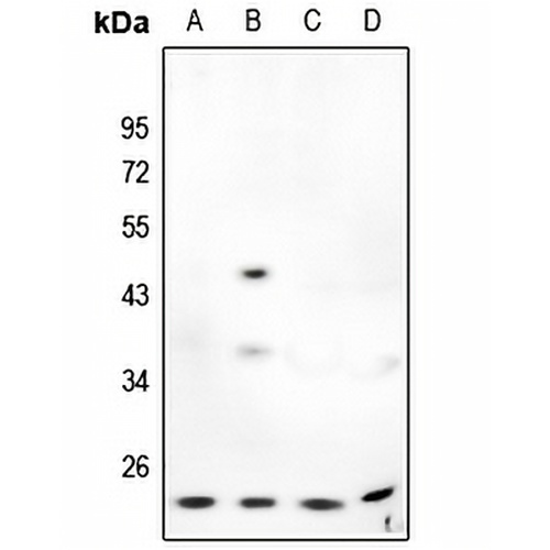 MMP7 Rabbit Polyclonal Antibody