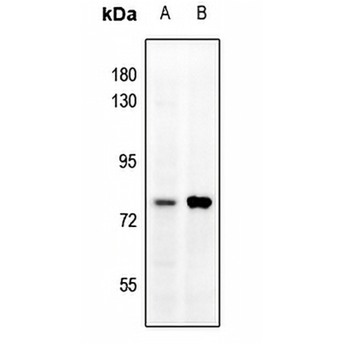 MMP9 Rabbit Polyclonal Antibody